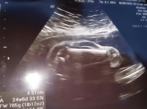 screen shot 2016-06-13 at 5.07.28 pm