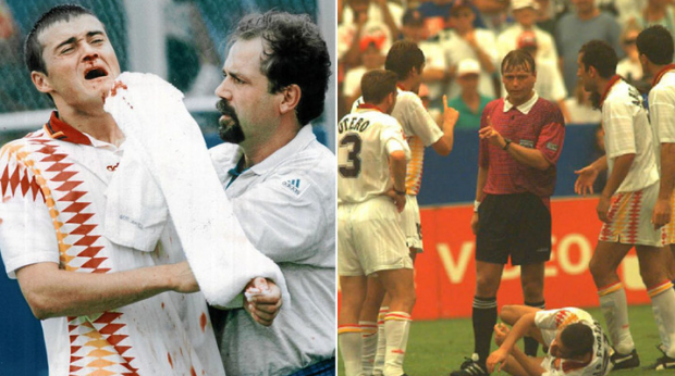 Fotbalul, sport sângeros. Cele mai dureroase accidentări din fotbalul mondial