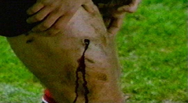 Fotbalul, sport sângeros. Cele mai dureroase accidentări din fotbalul mondial