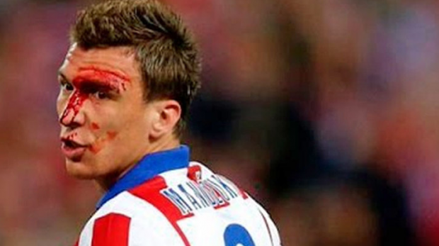 Fotbalul, sport sângeros. Cele mai dureroase accidentări din fotbalul mondial