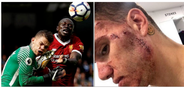 Fotbalul, sport sângeros. Cele mai dureroase accidentări din fotbalul mondial