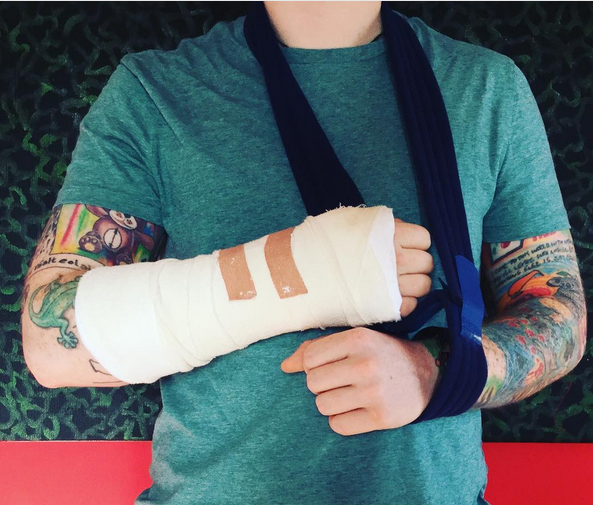 Ed Sheeran a fost implicat într-un accident cu bicicleta