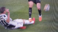 Mario Mandzukici, 10 puncte de sutură, după accidentarea pricinuită de Vecino