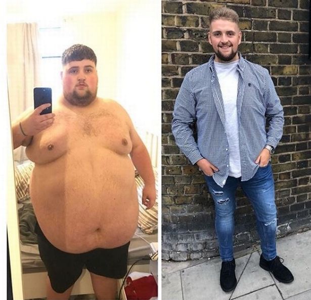 FOTO/ Cum arată bărbatul care a reușit să slăbească peste 100 de kilograme. Acum are o altă problemă