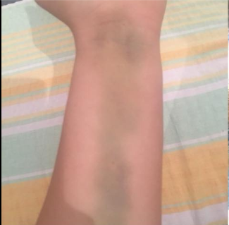 ACTUALIZARE / Handbalista Ada Iliescu are nevoie urgentă de 5.000 de lei. Sportiva nu mai aude cu urechea dreaptă