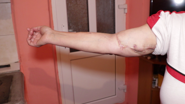 Condamnată la moarte și la recunoștință. De două decenii, o femeie dintr-un sat vasluian luptă pentru viață cu sistemul sanitar, cu geografia, cu birocrația, cu starea vremii