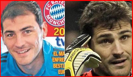 Fotbaliștii care și-au făcut implant de păr. Ștefan Radu și Walter Zenga, în top