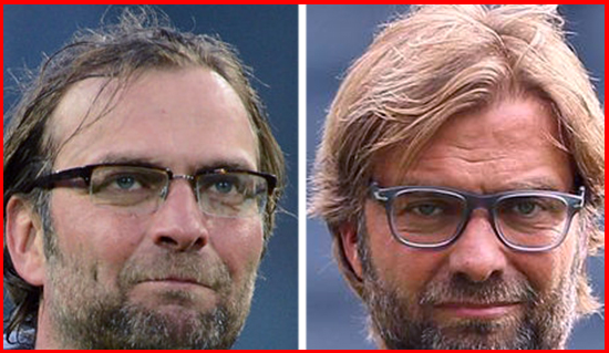 Fotbaliștii care și-au făcut implant de păr. Ștefan Radu și Walter Zenga, în top