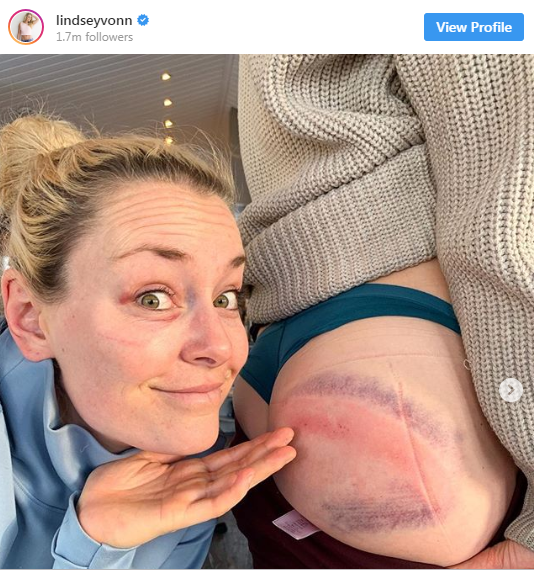 Lindsey Vonn arată fundul pe Twitter. Duminică are programată ultima cursă a carierei