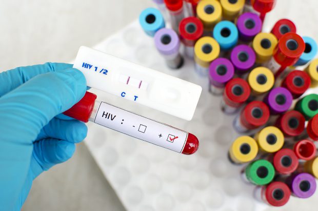 Un caz rar: al doilea pacient cu HIV care s-ar fi „vindecat” fără tratament cu celule stem