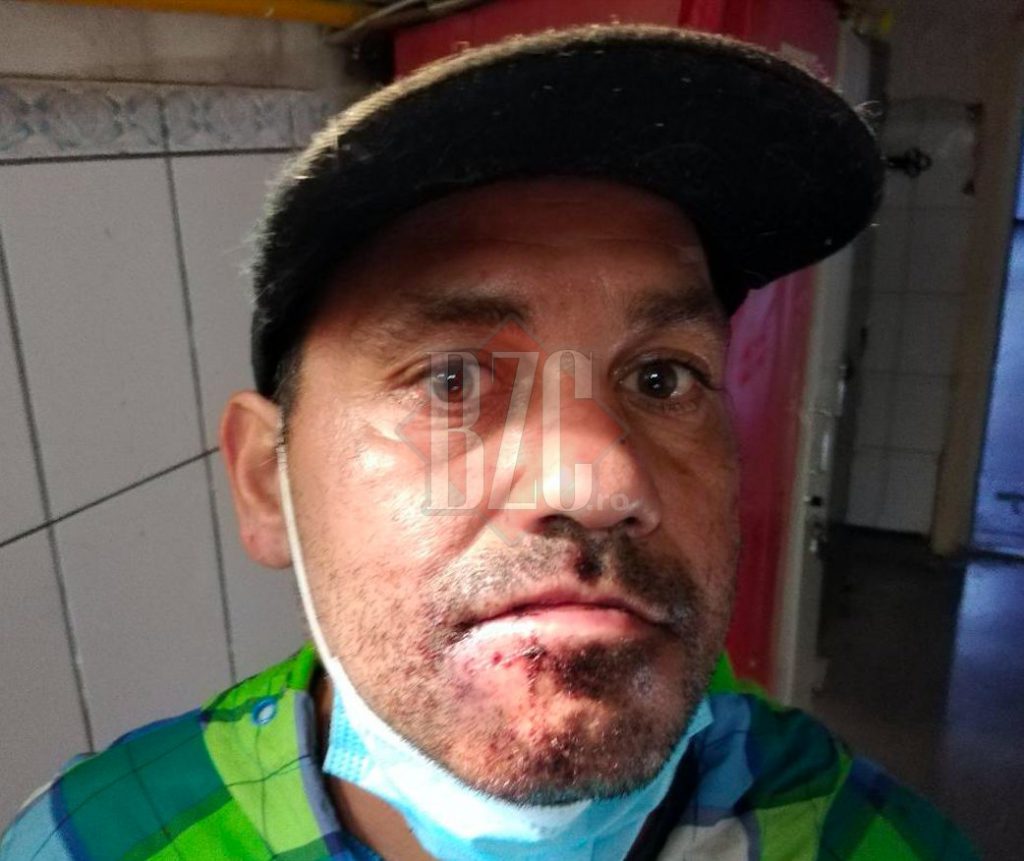 Un clujean susține că a fost bătut de controlorii de tren din cauză că nu avea bilet: “N-au anunțat poliția, m-au lăsat în stație, plin de sânge”