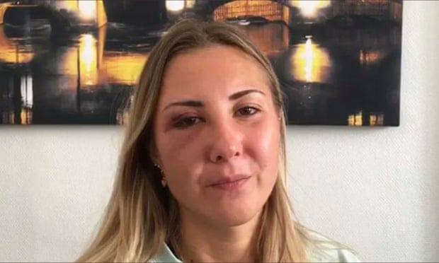 O tânără din Franța a fost bătută pe stradă pentru că purta fustă