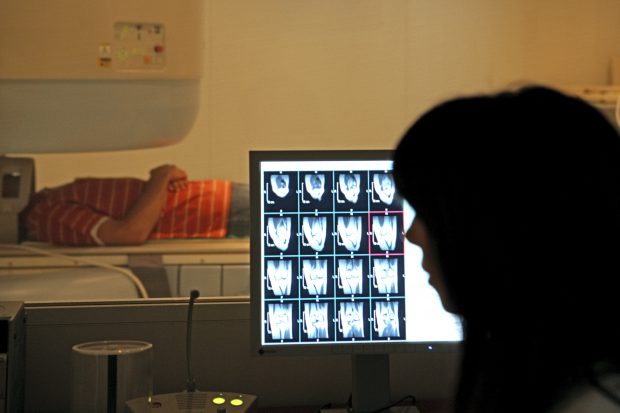 Studiu: Modurile ciudate prin care coronavirusul poate afecta creierul