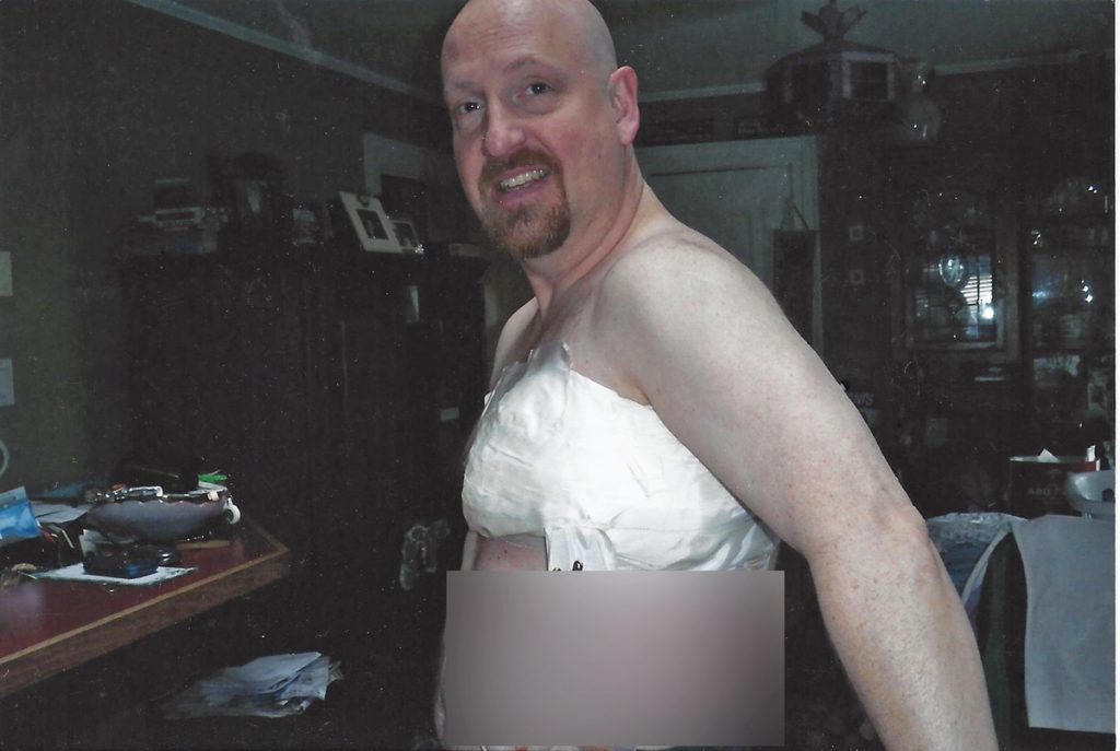 Un bărbat supraviețuitor de 10 ani de cancer își spune povestea: ”Habar n-aveam că bărbații ar putea face cancer de sân. Mi-a fost rușine și l-am numit cancer de piept”