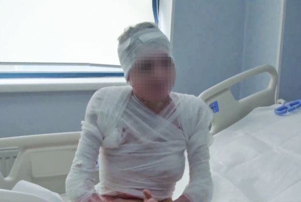 Strigăt de ajutor pentru fata din Mehedinți, incendiată de un criminal: Supraviețuitor Colectiv: „A trecut prin toate formele imaginabile de abuz”
