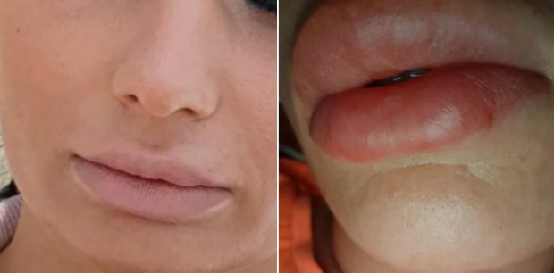 „Dr.Lana” şi soţul ei, reţinuţi de poliţie. Mărturiile clientelor desfigurate de pretinsul medic: „M-a făcut praf. Mi-am luat ţeapă cu pozele de pe Instagram”