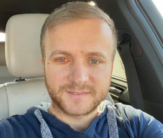 Activistul de mediu Daniel Bodnar caută ajutor pentru o intervenție chirurgicală în Germania