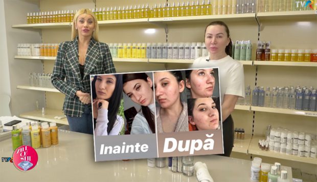 Opt luni de la scandalul Plush Bio. Niciun vinovat, tinere care nu au fost chemate la audieri, produse pentru ten promovate la TVR