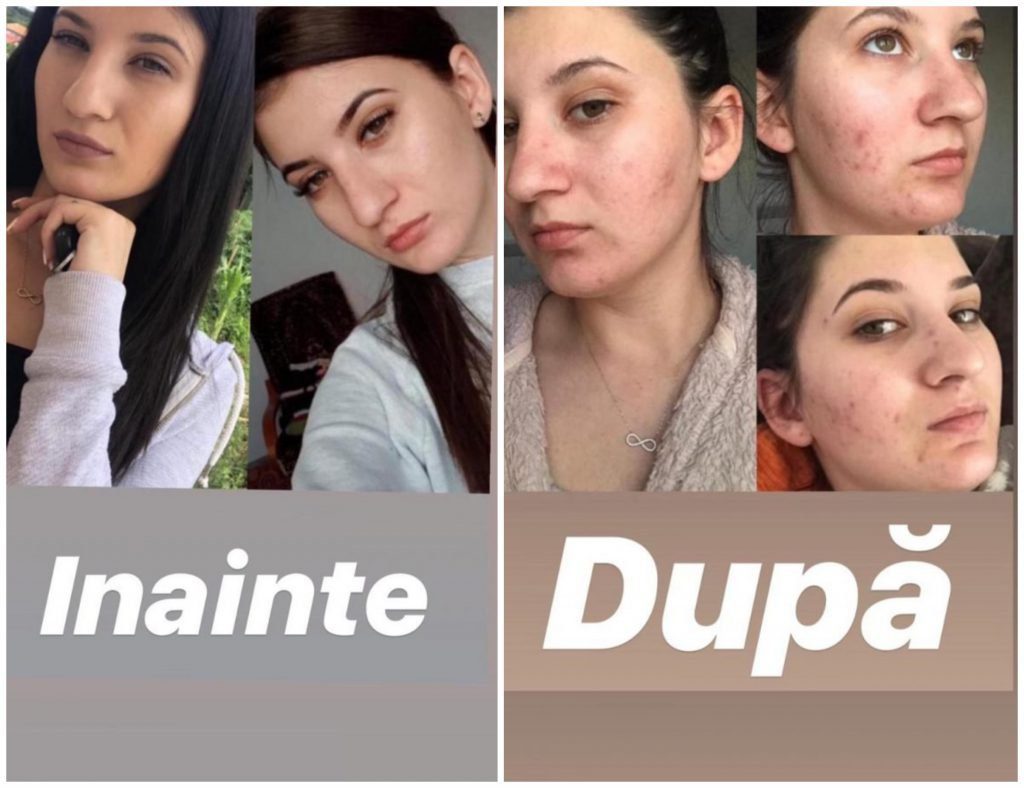 Opt luni de la scandalul Plush Bio. Niciun vinovat, tinere care nu au fost chemate la audieri, produse pentru ten promovate la TVR