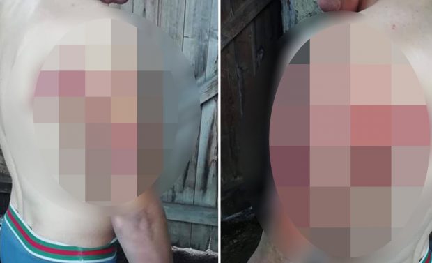 Dosar penal în cazul tânărului care susține că a fost bătut în secția de poliție, preluat de Parchetul Bacău