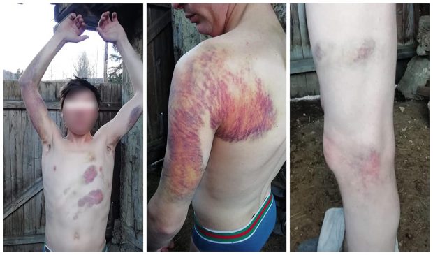 Tânăr dintr-o comună din Bacău bătut crunt după ce ar fi furat o pătură de fân, vecinii îl acuză pe șeful de post din sat. IPJ a sesizat Parchetul