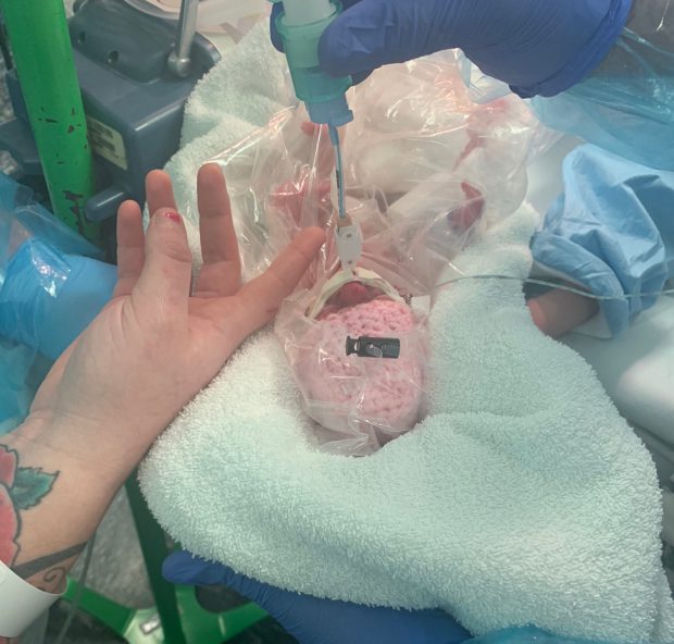 Un bebeluș născut prematur în Marea Britanie, salvat de medici cu ajutorul unei pungi de sandvici
