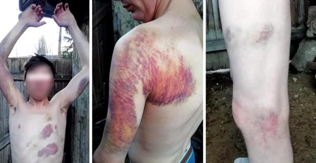 DOCUMENT. Ce a descoperit Medicina legală Moinești în cazul băiatului despre dintr-o comună din Bacău care ar fi fost bătut de un polițist