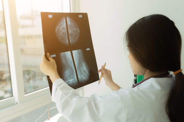 Cancerul de sân, cel mai răspândit tip de cancer din lume, depăşindu-l pe cel pulmonar