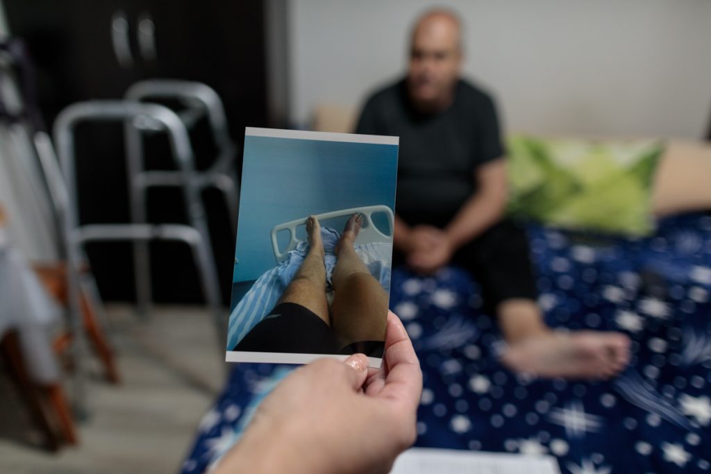 Rămas fără un picior după COVID, un bărbat îi acuză de neglijență pe medicii infecționiști de la spitalul din Slatina