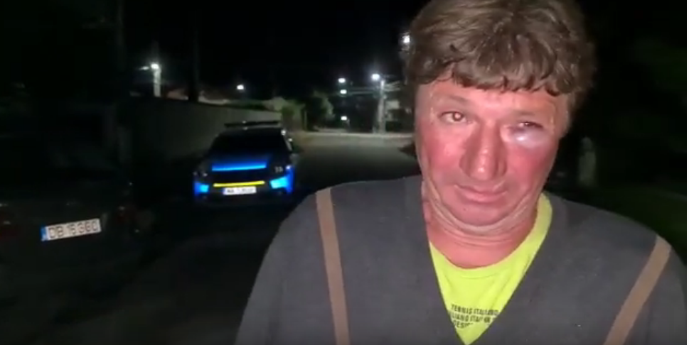 Un edil din Dâmbovița susține că a fost bătut de un localnic pe care l-a prins că arunca deșeuri: "Mi-a dat în falcă"