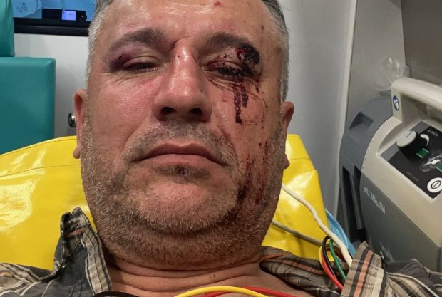 Un activist de mediu şi doi jurnaliști, bătuţi crunt în județul Suceava, când filmau un material despre tăierile ilegale de păduri