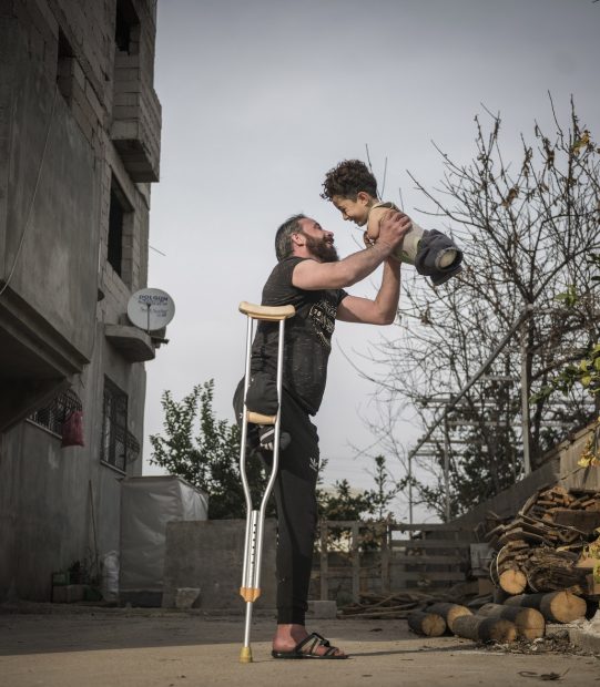 Puterea unei fotografii: Cum s-a schimbat viața unui tată sirian schilodit într-un atac cu bombă și a fiului său născut infirm