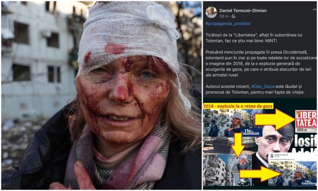 VIDEO DRAMATIC Femeia-simbol a războiului demască pentru cititorii Libertatea un fake-news: „Iată bucățile de sticlă care au rămas în mine când s-a produs explozia”