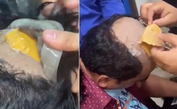 Aur de 40.000 de dolari lipit de cap, sub perucă, de un contrabandist indian chel
