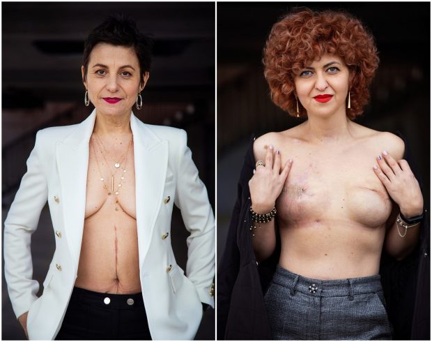 Lupta, supraviețuirea și schimbarea provocate de un diagnostic de cancer. Două femei povestesc cum au învins boala