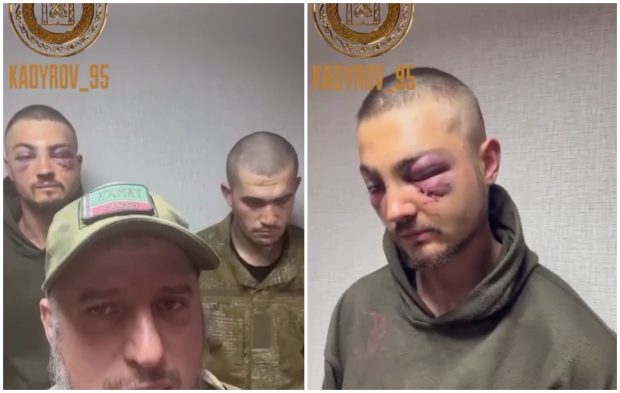 Soldat ucrainean capturat de cecenii lui Kadîrov, cu ochii învinețiți: „A călcat pe o greblă când se preda!”