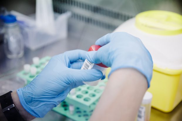 Marea Britanie a depistat alte 71 de cazuri de variola maimuţei. Câte cazuri a confirmat în total