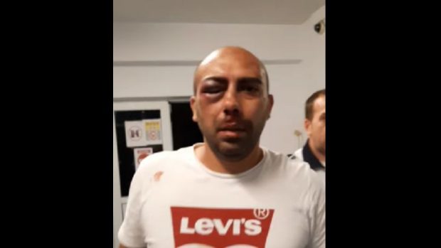 Un bărbat din Piatra Neamț acuză că a fost bătut în secția de poliție. Parchetul a deschis dosar penal