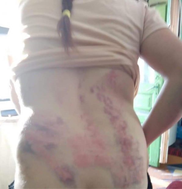 O femeie însărcinată, victima unor violențe extreme: bătută cu lanțul și sechestrată de către concubin
