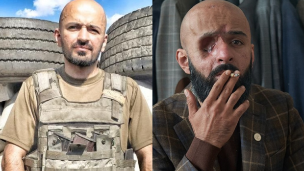 Soldat ucrainean care și-a pierdut ochiul drept pe front: „Cel mai rău este când îmi vine să plâng, dar nu mai pot”
