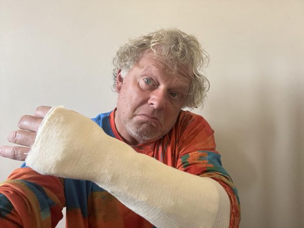 Leonard Miron a ajuns la spital cu mâna ruptă și o coastă fisurată: „M-am împiedicat și am alunecat vreo 4-5 trepte”