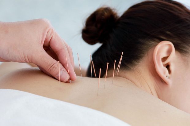 Terapia acupuncturii: Cum poate să îmbunătățească sănătatea ta?
