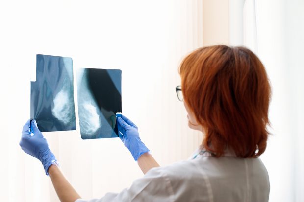 Zero mamografii decontate în nouă județe din țară anul trecut. În Suceava peste o sută de femei au murit de cancer la sân în 2020