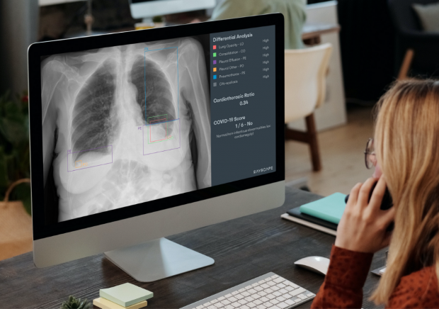 Medicii MedLife atrag atenția asupra importanței investigațiilor imagistice în diagnosticarea cancerului pulmonar și explică rolul inteligenței artificiale în acest proces