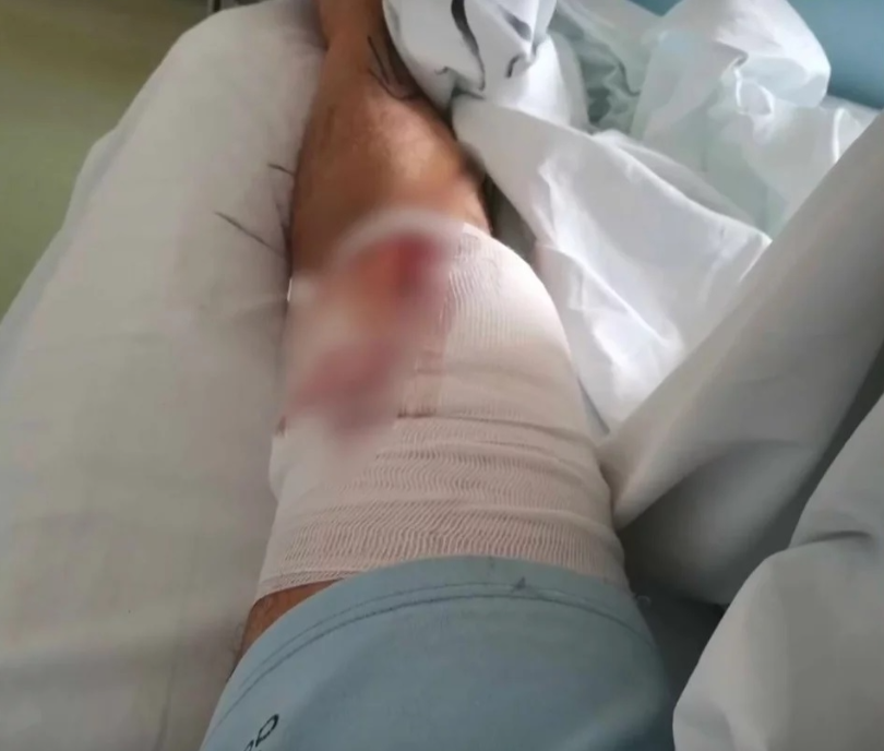 Un grec a fost rănit de un glonț rătăcit în timp ce își bea cafeaua pe balconul casei. „Mă lovește direct deasupra genunchiului”