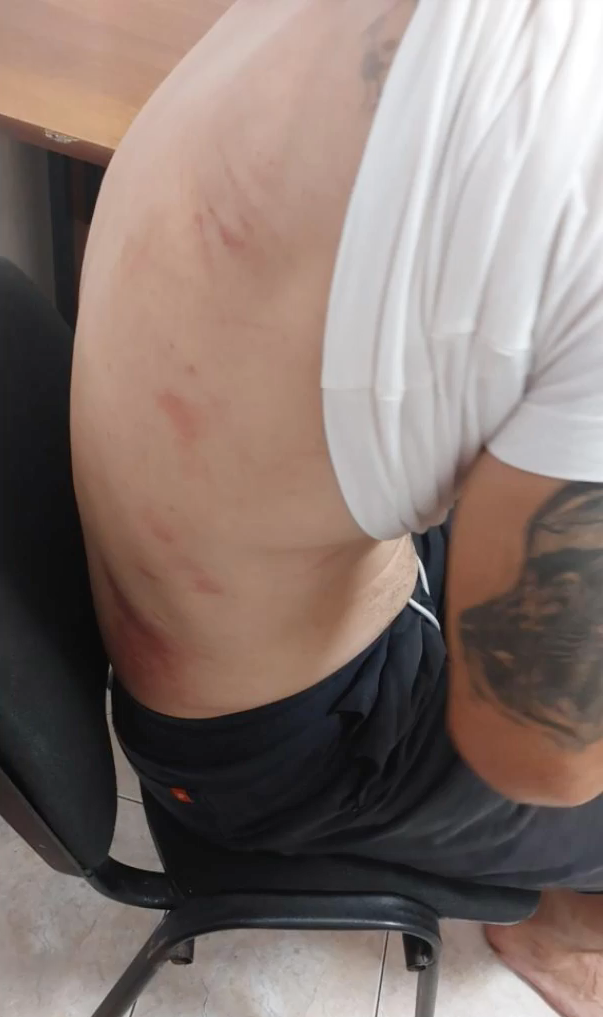 VIDEO. Echipaj al Poliției Locale Sector 2, acuzat că a agresat din motive rasiale o familie de romi în parc. „În mașină, unul mă ținea de cătușe și cel de lângă mine îmi dădea în coaste și la ficat”. Reacția Poliției