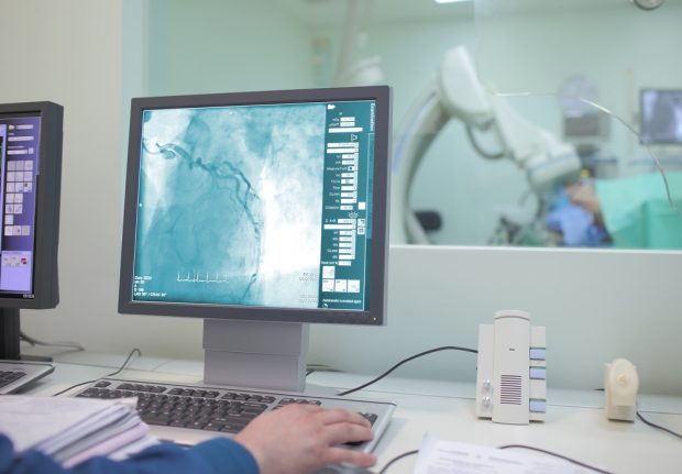 Coronarografia vs Tomografia computerizată: o analiză comparativă
