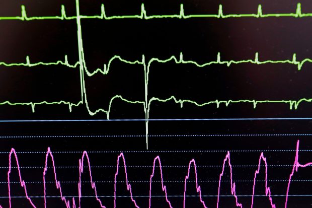 O femeie din Anglia a sunat la numărul de urgențe din patul de spital pentru că o asistentă a ignorat simptomele de pe monitorul ei cardiac