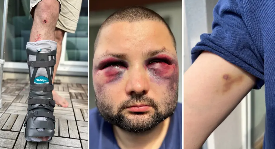 „A ta e mutra din afișul electoral? Atunci ia de aici!”. Poliția a prins suspecții care au bătut un politician german de origine română