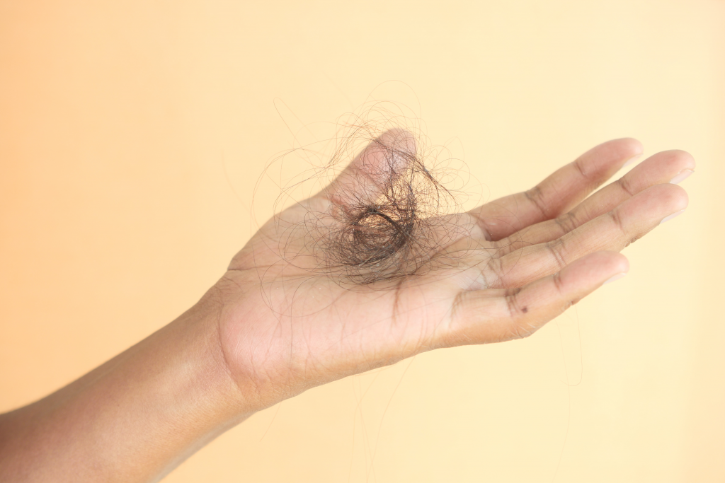 Alopecia - factori de risc, cauze și tratament. De ce chelesc bărbații